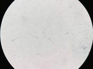 como se ve el semen con microscopio | espermatozides vagos